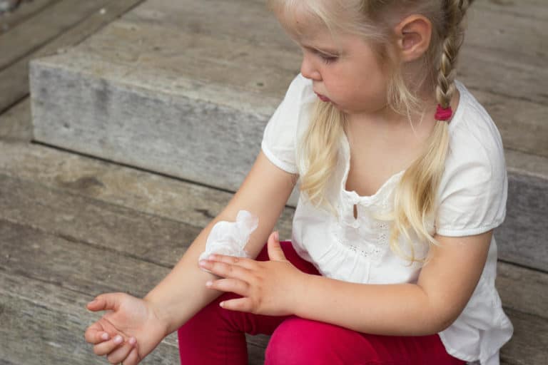 Ultimate Guide to Treating Dry Skin in Kids